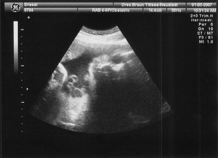 7. Ultraschallaufnahme